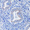 Ubiquitin Like With PHD And Ring Finger Domains 2 antibody, 15-099, ProSci, Immunohistochemistry paraffin image 