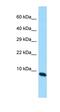 Putative uncharacterized protein C17orf91 antibody, orb326738, Biorbyt, Western Blot image 