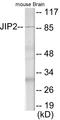 Mitogen-Activated Protein Kinase 8 Interacting Protein 2 antibody, EKC1795, Boster Biological Technology, Western Blot image 