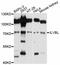 IlvB Acetolactate Synthase Like antibody, abx126001, Abbexa, Western Blot image 