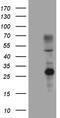 ERCC Excision Repair 8, CSA Ubiquitin Ligase Complex Subunit antibody, CF808545, Origene, Western Blot image 