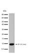 C-X-C Motif Chemokine Ligand 10 antibody, 710399, Invitrogen Antibodies, Western Blot image 