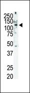 Ret Proto-Oncogene antibody, 63-125, ProSci, Western Blot image 