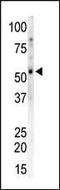 Calcium/Calmodulin Dependent Protein Kinase II Gamma antibody, MBS9201381, MyBioSource, Western Blot image 