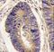 Protein Tyrosine Phosphatase Non-Receptor Type 3 antibody, LS-C101002, Lifespan Biosciences, Immunohistochemistry frozen image 