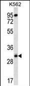 Ribosomal Protein S4 Y-Linked 1 antibody, PA5-71753, Invitrogen Antibodies, Western Blot image 