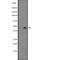 Calcium Activated Nucleotidase 1 antibody, abx148273, Abbexa, Western Blot image 