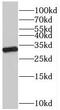 Voltage Dependent Anion Channel 2 antibody, FNab09387, FineTest, Western Blot image 