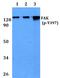 Protein Tyrosine Kinase 2 antibody, A00151Y397, Boster Biological Technology, Western Blot image 