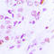 Lysine Acetyltransferase 2A antibody, LS-C353989, Lifespan Biosciences, Immunohistochemistry paraffin image 