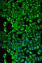 Proteasome 26S Subunit, Non-ATPase 2 antibody, 18-436, ProSci, Immunofluorescence image 