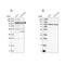 TBC1 Domain Family Member 5 antibody, NBP1-93653, Novus Biologicals, Western Blot image 