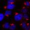 Alpha-L-Fucosidase 1 antibody, PA5-47894, Invitrogen Antibodies, Immunocytochemistry image 