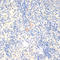 FOXP3 antibody, LS-C747257, Lifespan Biosciences, Immunohistochemistry paraffin image 