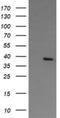 Nudix Hydrolase 9 antibody, NBP2-46277, Novus Biologicals, Western Blot image 