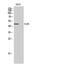 CLN5 Intracellular Trafficking Protein antibody, A04893-1, Boster Biological Technology, Western Blot image 