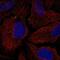 Transmembrane Protein 198 antibody, NBP2-59008, Novus Biologicals, Immunofluorescence image 