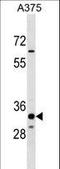 Thioesterase Superfamily Member 5 antibody, LS-C157190, Lifespan Biosciences, Western Blot image 