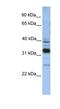 Thioredoxin Related Transmembrane Protein 4 antibody, NBP1-62600, Novus Biologicals, Western Blot image 