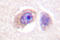 Protein Tyrosine Kinase 2 antibody, LS-C176511, Lifespan Biosciences, Immunohistochemistry frozen image 
