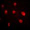 Lysine Methyltransferase 5A antibody, orb341270, Biorbyt, Immunofluorescence image 
