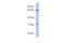 PDZ Binding Kinase antibody, 26-354, ProSci, Enzyme Linked Immunosorbent Assay image 