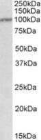 Interleukin-12 receptor subunit beta-1 antibody, MBS422385, MyBioSource, Western Blot image 