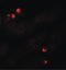 Serum/Glucocorticoid Regulated Kinase 1 antibody, LS-C144375, Lifespan Biosciences, Immunofluorescence image 