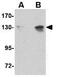 Nucleoporin 155 antibody, GTX31353, GeneTex, Western Blot image 
