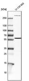 Endoglin antibody, NBP1-91212, Novus Biologicals, Western Blot image 