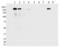 Leucine Rich Repeat Kinase 2 antibody, ab133450, Abcam, Western Blot image 