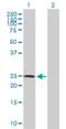 Ring Finger Protein 114 antibody, H00055905-D01P, Novus Biologicals, Western Blot image 
