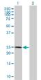 RING finger protein 114 antibody, H00055905-D01P, Novus Biologicals, Western Blot image 