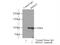 RNA Binding Motif Protein 15 antibody, 66059-1-Ig, Proteintech Group, Immunoprecipitation image 