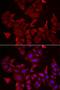 Caspase 14 antibody, LS-C334785, Lifespan Biosciences, Immunofluorescence image 