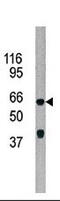 AarF Domain Containing Kinase 5 antibody, 62-665, ProSci, Western Blot image 