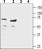 Cholinergic Receptor Nicotinic Beta 1 Subunit antibody, TA328886, Origene, Western Blot image 