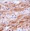 Discoidin Domain Receptor Tyrosine Kinase 2 antibody, LS-C164363, Lifespan Biosciences, Immunohistochemistry paraffin image 