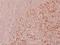 Glycogen Synthase Kinase 3 Alpha antibody, A03152S21, Boster Biological Technology, Immunohistochemistry paraffin image 