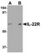 Interleukin 22 Receptor Subunit Alpha 1 antibody, A05705-1, Boster Biological Technology, Western Blot image 