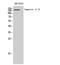 Laminin Subunit Gamma 3 antibody, STJ93897, St John