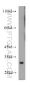 Tetraspanin 6 antibody, 12293-1-AP, Proteintech Group, Western Blot image 