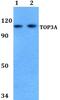 DNA Topoisomerase III Alpha antibody, PA5-75799, Invitrogen Antibodies, Western Blot image 