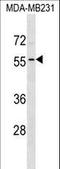 Adenosine Deaminase TRNA Specific 1 antibody, LS-C161008, Lifespan Biosciences, Western Blot image 