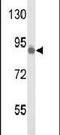 Tousled Like Kinase 1 antibody, PA5-15374, Invitrogen Antibodies, Western Blot image 