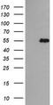 Tripartite Motif Containing 44 antibody, M11544-1, Boster Biological Technology, Western Blot image 