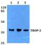 Tumor Associated Calcium Signal Transducer 2 antibody, GTX66651, GeneTex, Western Blot image 