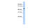 General Transcription Factor IIE Subunit 1 antibody, 27-249, ProSci, Western Blot image 