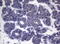 Centrosomal Protein 55 antibody, M03954, Boster Biological Technology, Immunohistochemistry paraffin image 
