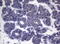 Centrosomal protein of 55 kDa antibody, M03954, Boster Biological Technology, Immunohistochemistry paraffin image 